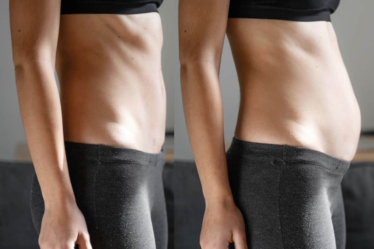 How long does diastasis recti take to improve Merton Park?