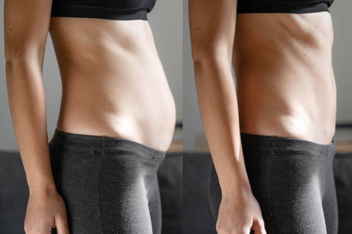 Post-Pregnancy: What Happens to Your Abdominal Muscles After Birth Merton Park