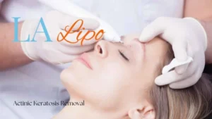 Woman receiving Actinic Keratosis Removal Treatment Merton Park
