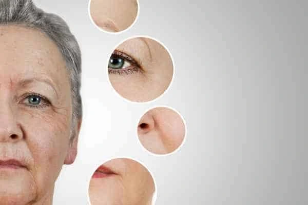 HIFU Facelift Merton Park from LA LIPO