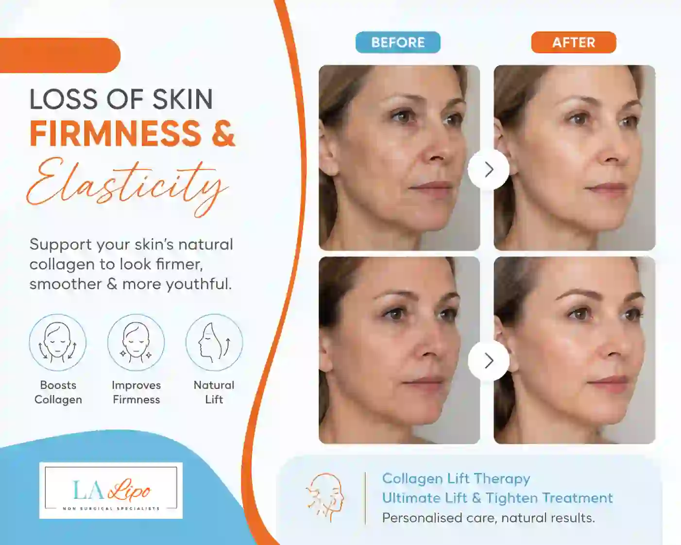 Sign #7: Loss of Skin Firmness and Elasticity Merton Park