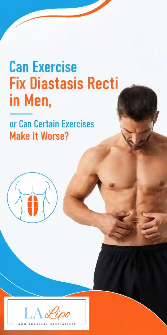 Can Exercise Fix Diastasis Recti in Men, or Can Certain Exercises Make It Worse Merton Park?
